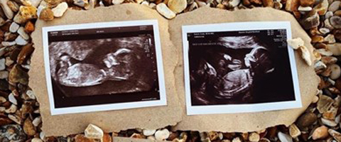 Kerry & Emily's story